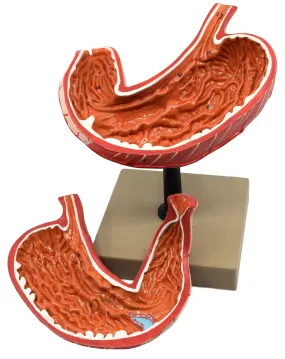 Human Stomach Model, 2 Parts, Three Dimensional, Sectional View with Hand Painted Details - Mounted on Base, 5" x 5" x 7.5" - Eisco Labs